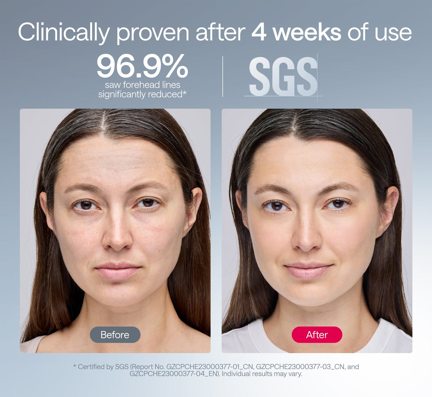 Ulike ReGlow + Ulike ReGlow Lite