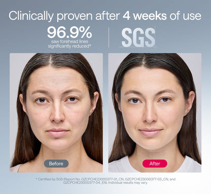 Ulike ReGlow + Ulike ReGlow Lite