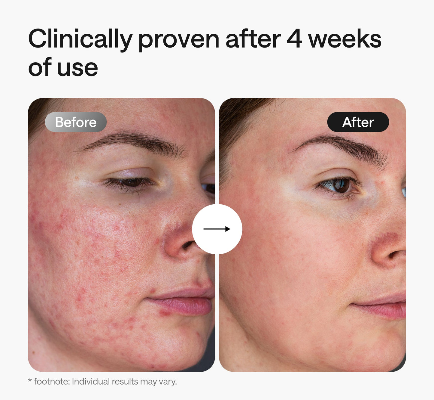 Ulike ReGlow + Ulike ReGlow Lite