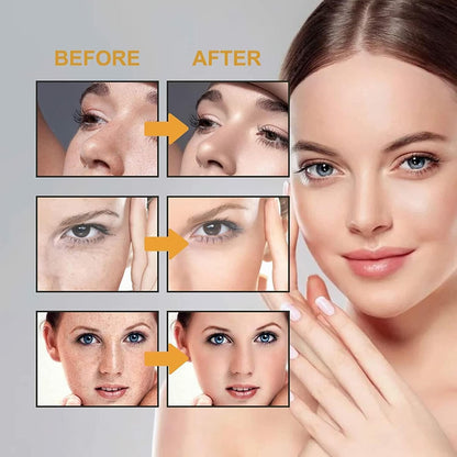 Japenese Melasma Cream